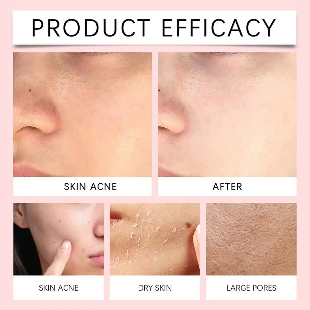 Centella Asiatica Tiefenreinigungs-Gesichtsreiniger – Sanfte Pflege, entfernt Öl & Schmutz | Beruhigend, feuchtigkeitsspendend, ideal für empfindliche Haut