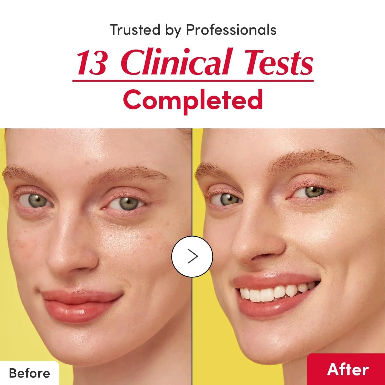 SANENDI CPNP Certified Anti-Aging & Freckle Removal Liquid Face Serum (Made in Korea)